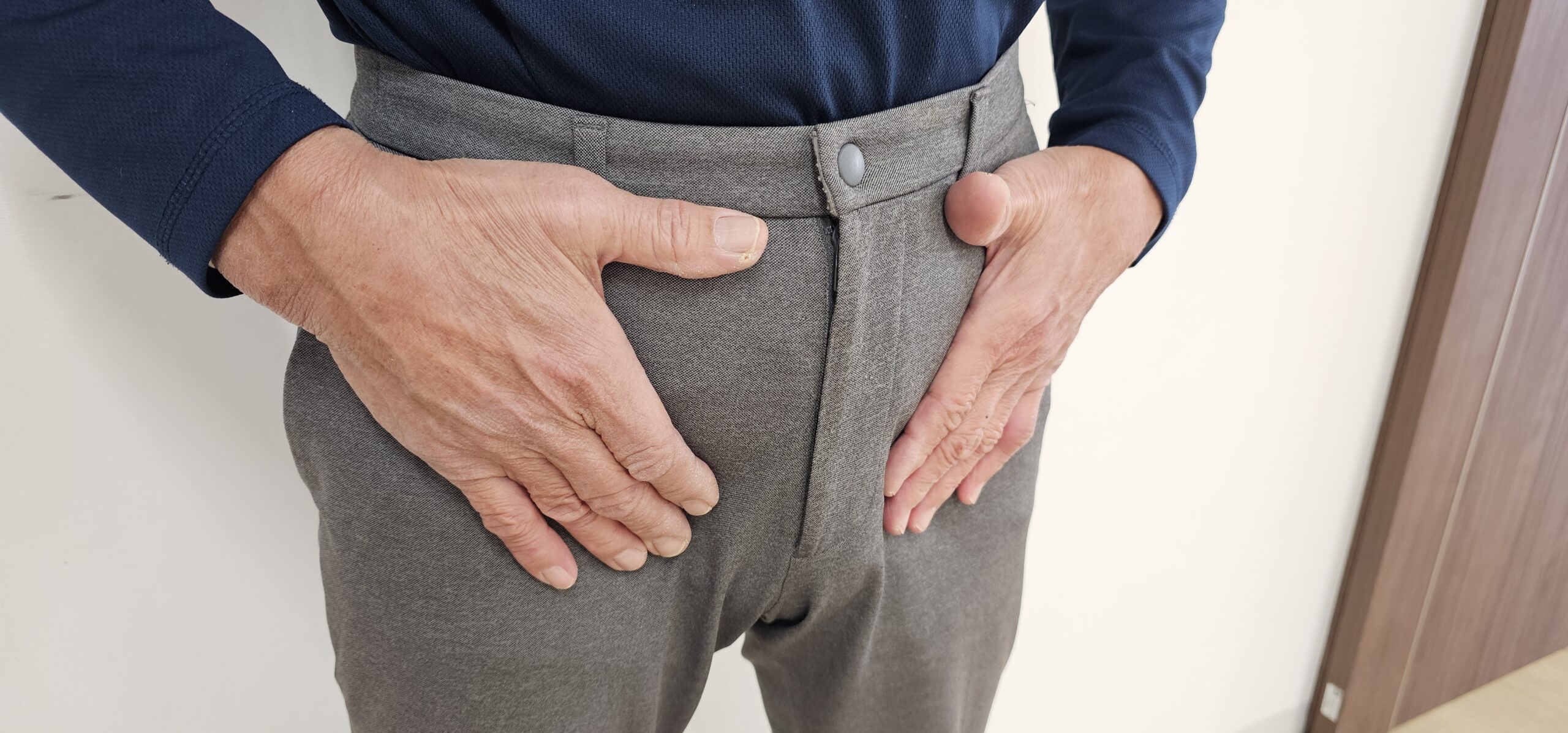 「脱腸」は「鼠径ヘルニア」のこと？気になる症状をチェック！