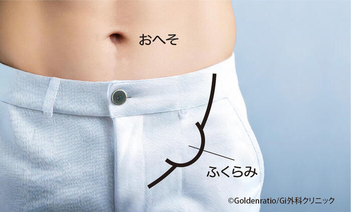鼠径ヘルニア（脱腸）の見た目｜  「写真と違う」「わからない」と感じる人が確認すべき5つの視点